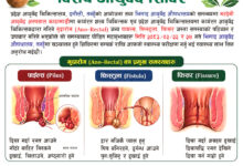 Photo of भिमादमा गुदारोग सम्बन्धी विशेष आयुर्वेद शिविर